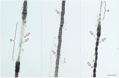 Clinical Course and Diagnostic Findings of Biopsy Controlled Presumed Immune-Mediated Polyneuropathy in 70 European Cats